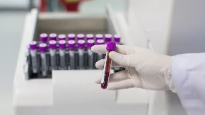 Hemoglobin "podivlja" od ovih namirnica, može rasti kao lud: Evo koja hrana može popraviti krvnu sliku