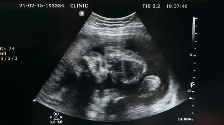 Placenta u trudnoći: Najvažniji organ koji hrani, štiti i oblikuje razvoj vaše bebe