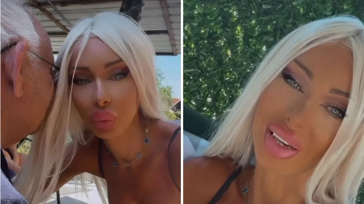"Ovo je deda koji mi je kupio prve grudi" Srpkinja se udala za milionera, pa pokazala ko joj je sve platio
