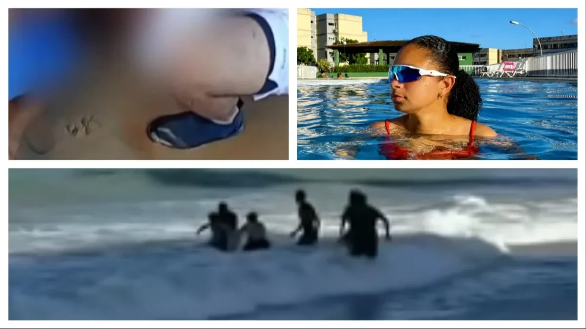 Ajkula odgrizla devojci (19) nogu! Jezive scene sa plaže, dan pre stradao školarac (11)