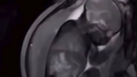 Zašto bebe vole tapkanje dok tonu u san? Babica Radmila dala jednostavno objašnjenje koje će razumeti svaki roditelj