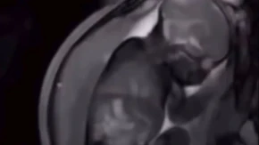 Zašto bebe vole tapkanje dok tonu u san? Babica Radmila dala jednostavno objašnjenje koje će razumeti svaki roditelj