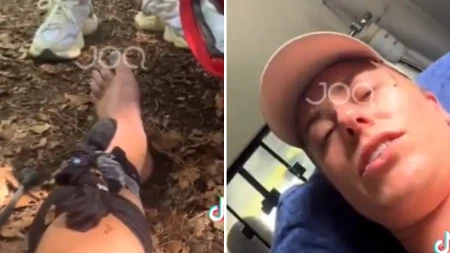 Turistkinju ujela najotrovnija zmija Albanije, prenosila uživo borbu za život! (VIDEO)