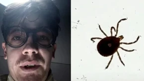 Stavio je krpelja u zamrzivač na 24 sata, a onda je usledio obrt: Gledaoci u neverici čekaju nastavak