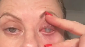 Ova žena (47) preživljava noćnu moru: Oprala je lice dok je nosila kontaktna sočiva, preti joj gubitak vida