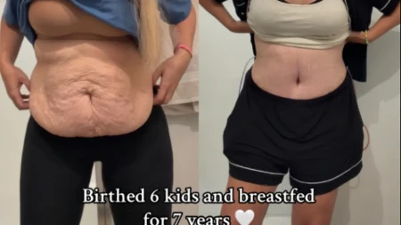 Mama šestoro dece pokazala telo bez filtera: Milioni gledaju šta trudnoća zaista ostavlja