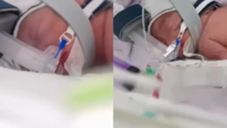 Lekari zanemeli! Jedna jajna ćelija postala četiri bebe – ovakav porođaj svet gotovo ne pamti