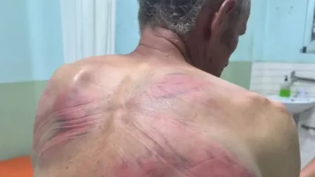 Horor kod Zubinog Potoka! Kurtijevi policajci Srbina vezali za drvo i tukli crevom, terali ga da prizna ratni zločin