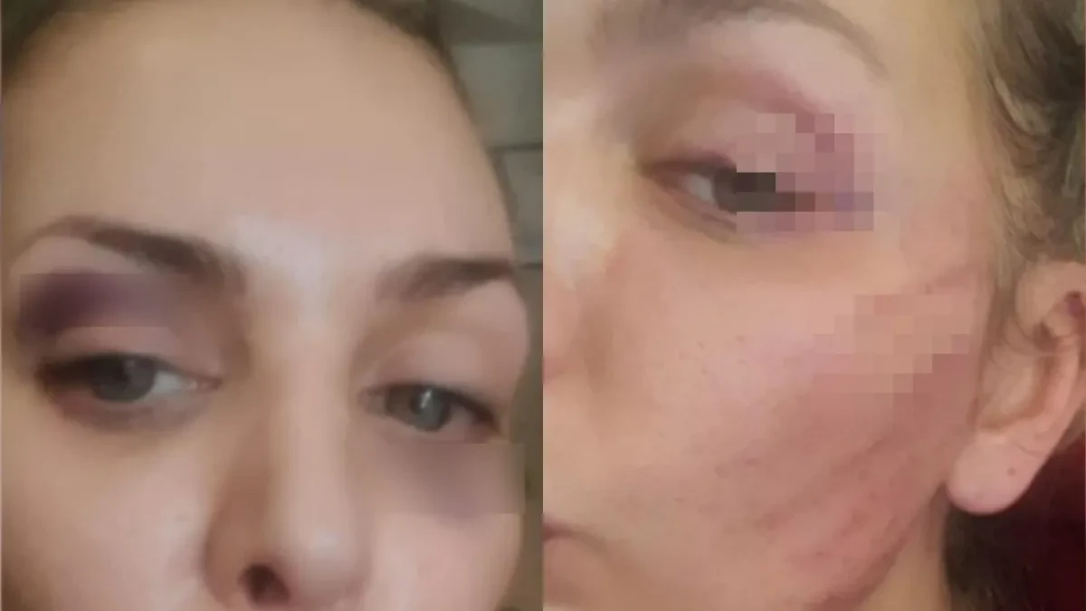 Prebio je, a sad se pomirila sa njim?! Ava Karabatić posle brutalog nasilja opet sa bivšim: "Pili su alkohol"