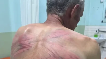 Šiptarski teroristi čereče Srbe, Brisel se pravi mutav! Srbin u teškom stanju, ima teške povrede glave!