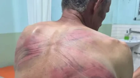 "Rašković ima kontuziju glave, povrede grudnog koša, slomljeno rebro, psihičku traumu" Elek: Ovde nije reč samo o prebijanju, ovo je pokušaj ubistva