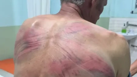 "Rašković ima kontuziju glave, povrede grudnog koša, slomljeno rebro, psihičku traumu" Elek: Ovde nije reč samo o prebijanju, ovo je pokušaj ubistva
