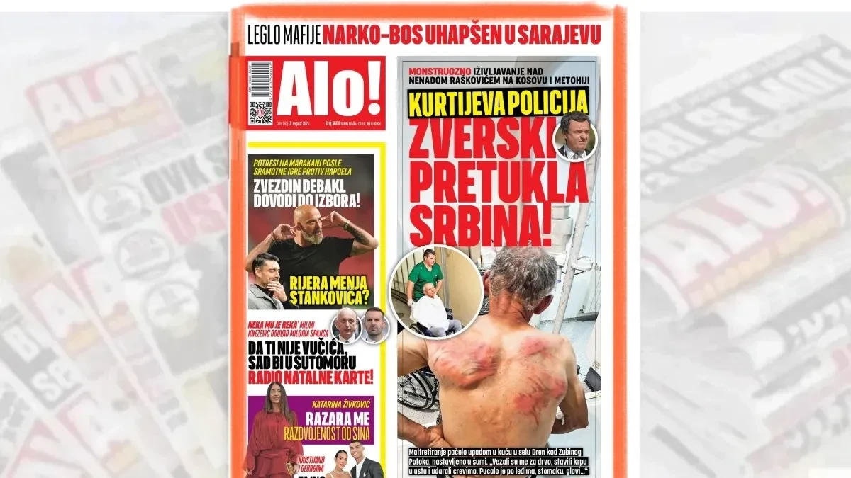 Monstruozno: Stravično maltretiranje Nenada Raškovića na Kosovu i Metohiji