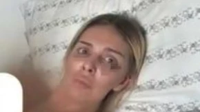 Ava Karabatić naga vezana za krevet: Pokazala modrice, jeziva fotka ledi krv u žilama! (FOTO 18+)