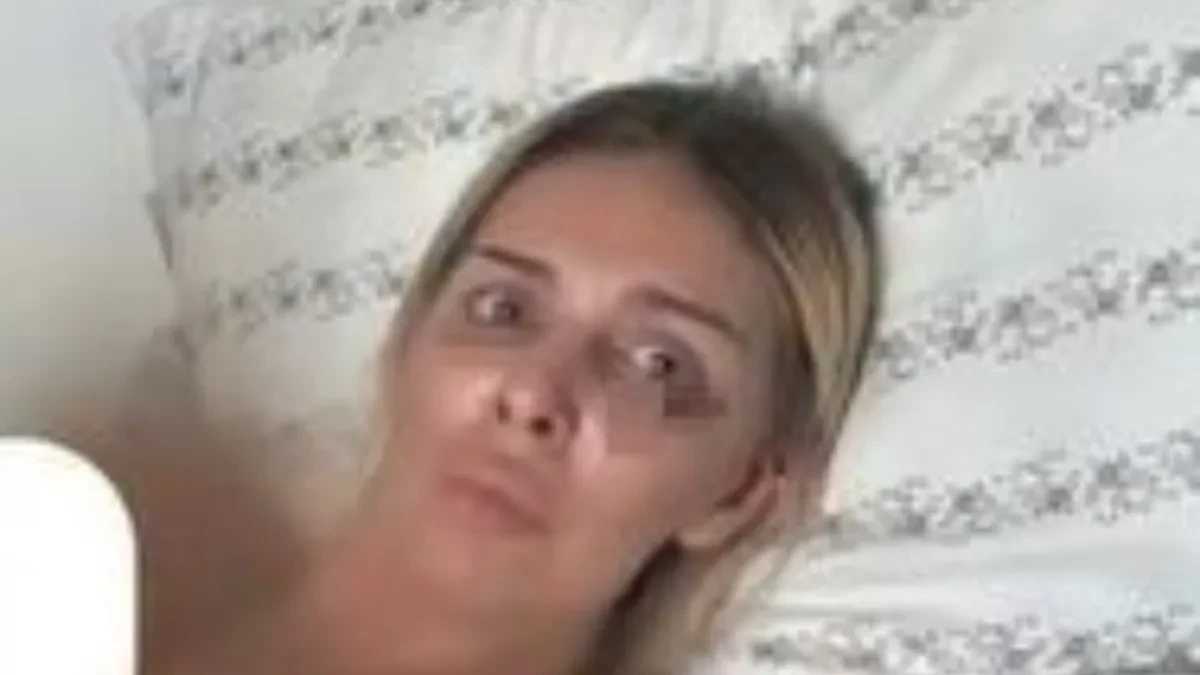 Ava Karabatić naga vezana za krevet: Pokazala modrice, jeziva fotka ledi krv u žilama! (FOTO 18+)