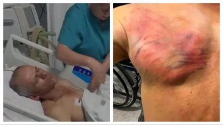 Srbin kog je tukla Kurtijeva policija u šok sobi! Vezali su ga za drvo i tukli crevom, ima teške povrede
