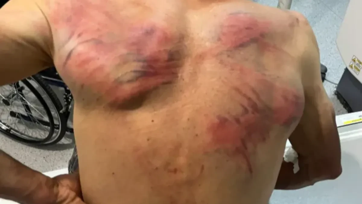 Palo priznanje u Prištini: Policijski inspektorat traži suspenziju "policajaca" koji su pretukli Nenada Raškovića