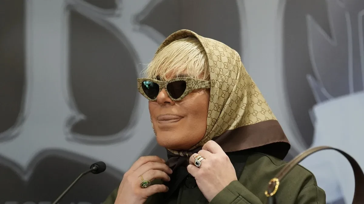 Isplivala fotka Bokija 13 pre svih operacija: Ni rođena majka ga ne bi prepoznala, ljudi u neverici (FOTO)