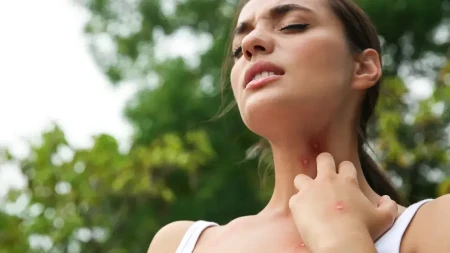 Zašto komarci baš vas izujedaju, a nekog pored vas ni ne pipnu? Evo zbog čega se to dešava