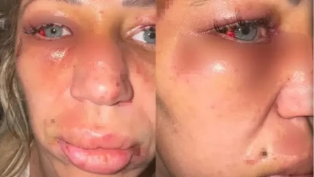 Influenserka objavila jezivi snimak nasilja: Muškarac je nokautirao, pa vukao po podu: "Nisam smela da pričam"
