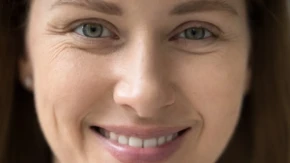 Ne trebaju vam igla i špric, sve može da se reši za mnogo manje pare: Kako ublažiti bore oko očiju?
