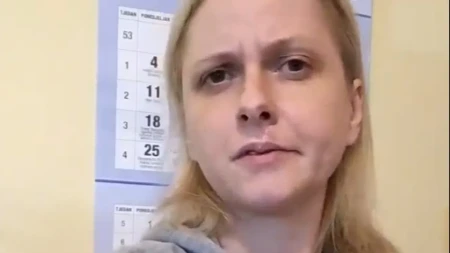 Glumica otišla kod lekara zbog bubuljice na usni, pa saznala da ima karcinom, operisana čak 5 puta! (FOTO)